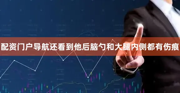 配资门户导航还看到他后脑勺和大腿内侧都有伤痕